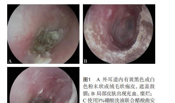 小猫皮疹，宠物主人必看（了解小猫耳朵后皮疹的成因和治疗方法）