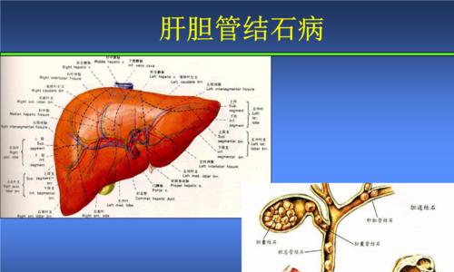 胆管性肝炎猫咪，猫咪胆管肝炎的症状有哪些？怎样治疗胆管肝炎？