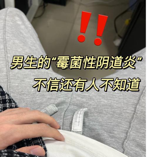 阴虱和宠物有关吗？女生怎么处理？