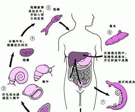 宠物寄生虫传给人怎么预防和处理？